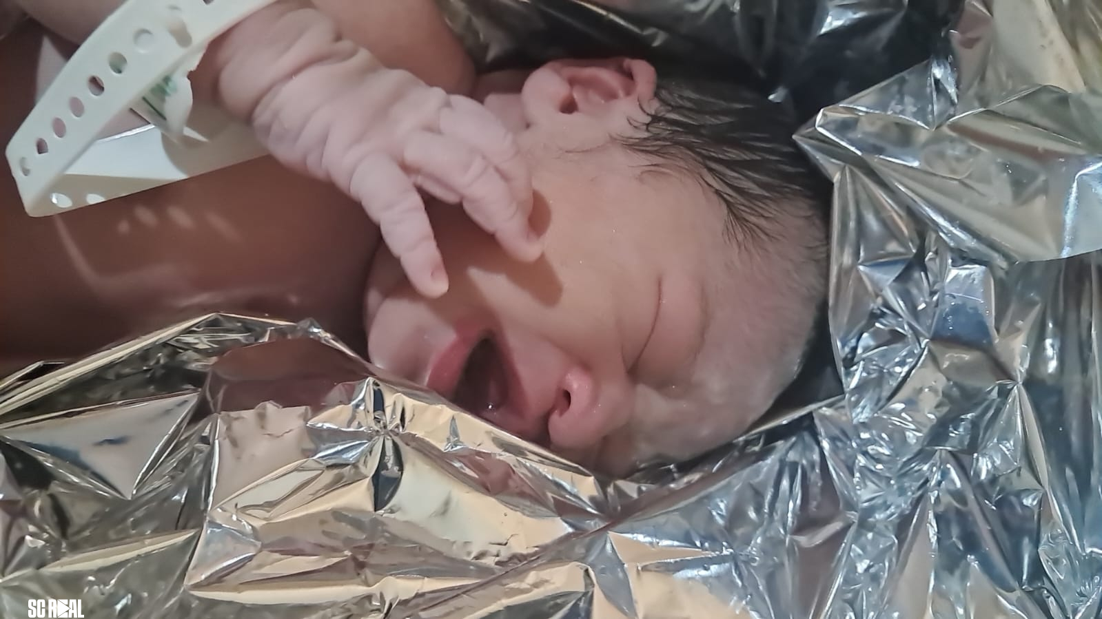 Equipe do SAMU realiza parto de emergência no bairro Morretes, em Itapema 